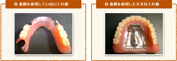 金属を使用していない入れ歯と使用している入れ歯